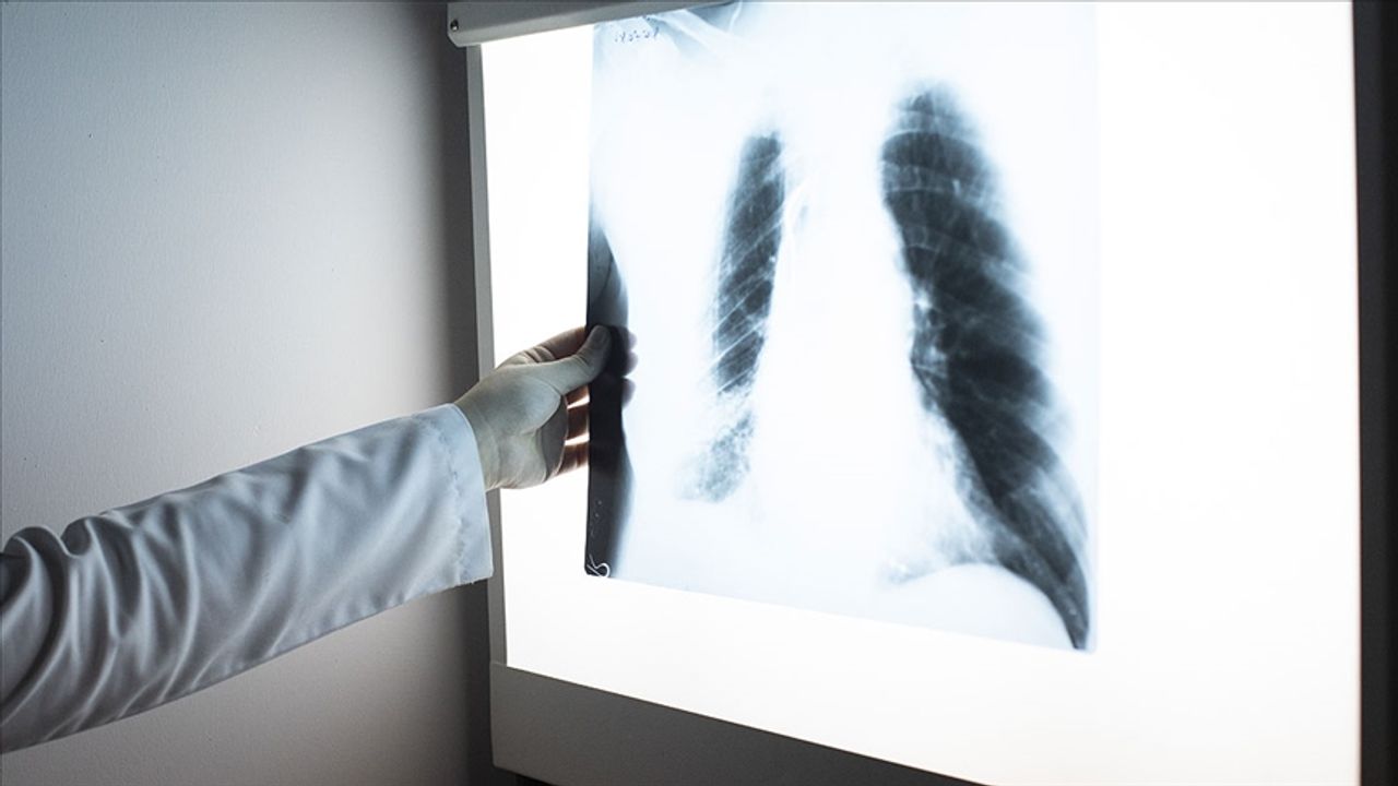 Kış aylarında zatürreye dikkat