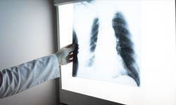 Kış aylarında zatürreye dikkat