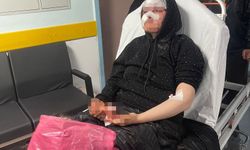 Boşanmak isteyen kadın darp edildi