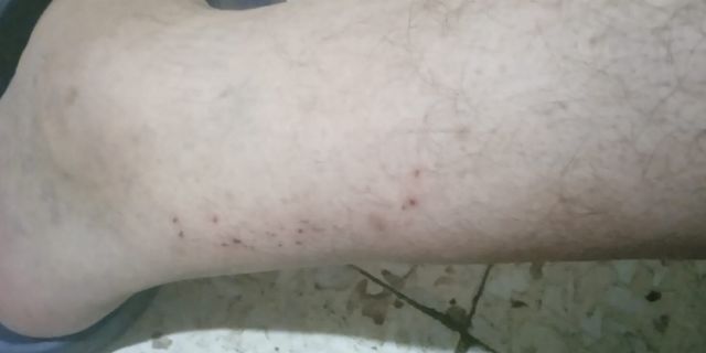 Alaybey’de sivrisinek isyanı! “Kendi evimizde yatamıyoruz”