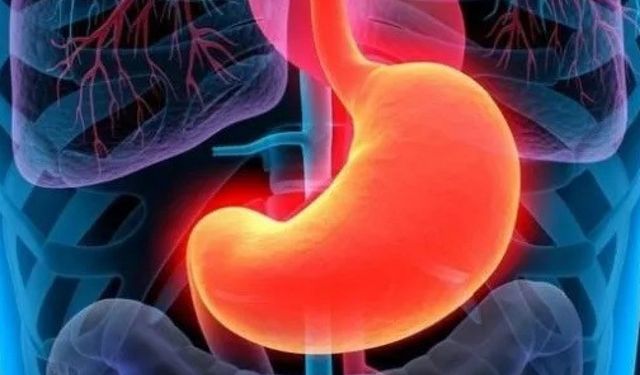 Mide kanserine karşı ‘yeni mide’ çözümü!