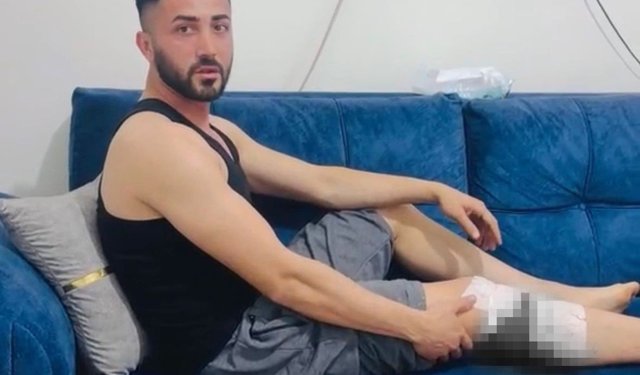 Nizip’te vatandaşlara köpek saldırdı