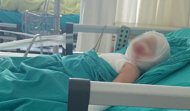 Patlayan konserve kavanozu bebeği yaktı