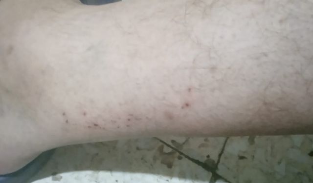 Alaybey’de sivrisinek isyanı! “Kendi evimizde yatamıyoruz”
