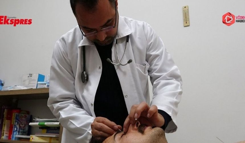 Gaziantep'te Akupunktur tedavisiyle ağrılara son