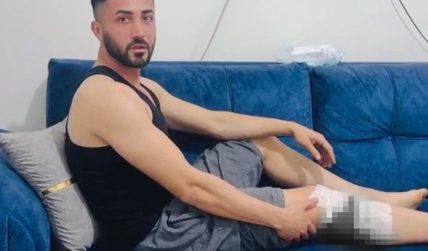 Nizip’te vatandaşlara köpek saldırdı