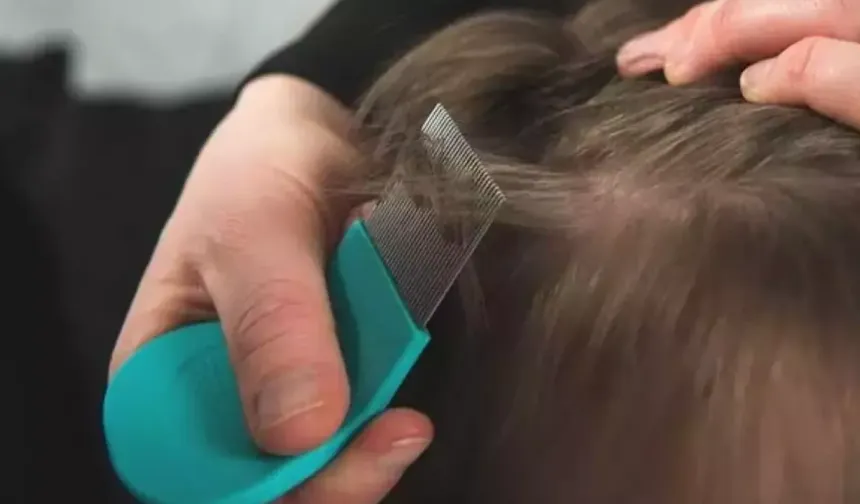 Okullar açıldı! Çocuğunuzun saçını mutlaka kontrol edin