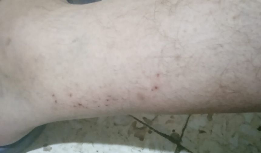 Alaybey’de sivrisinek isyanı! “Kendi evimizde yatamıyoruz”