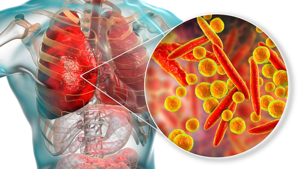 Zaturre Nedir 1024X576